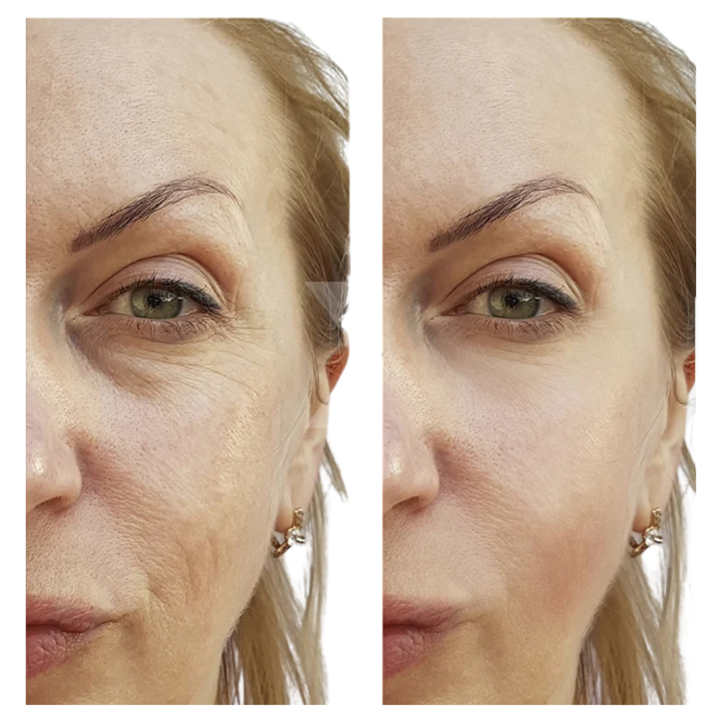 🔬 LUMISKIN GOLD – Evoliss® x ANLAN™