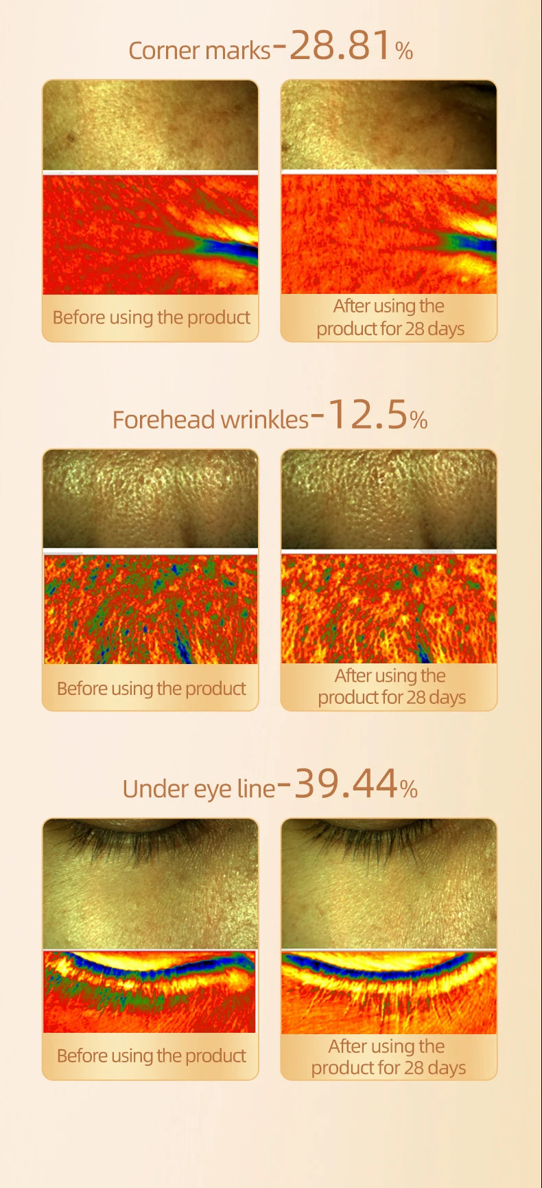 💫 SKINLIFT GOLD 24K de Evoliss® x FITTOP