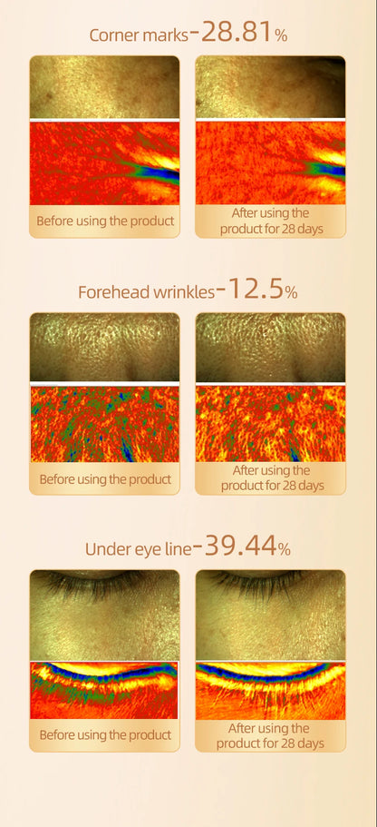 💫 SKINLIFT GOLD 24K de Evoliss® x FITTOP