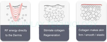 ⚜️ RF TRIPOLAR PRO de Evoliss® x MEJINLAY™ – Édition exclusive - Lifting professionnel à domicile